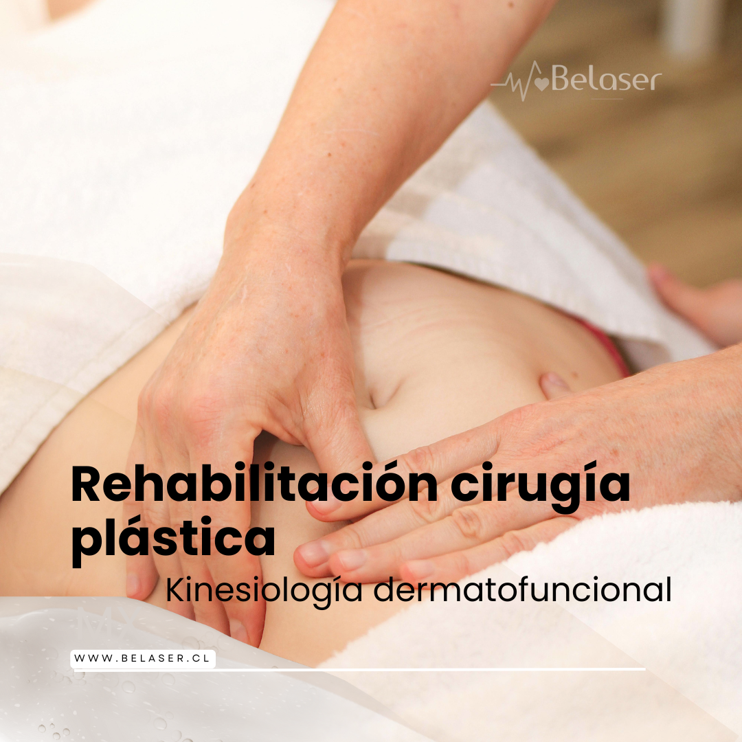 Rehabilitación en Cirugía plástica y reconstructiva