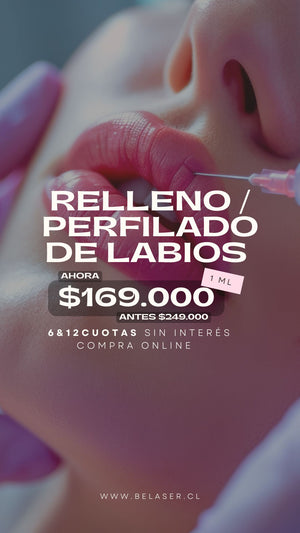Relleno  y perfilado de labios