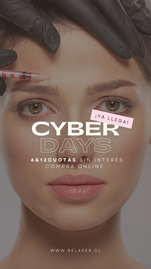 Relleno de ojeras con ácido hilurónico