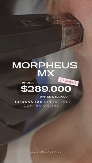 Morpheus MX