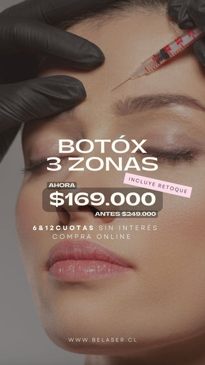 Toxina Botulínica 3 Zonas
