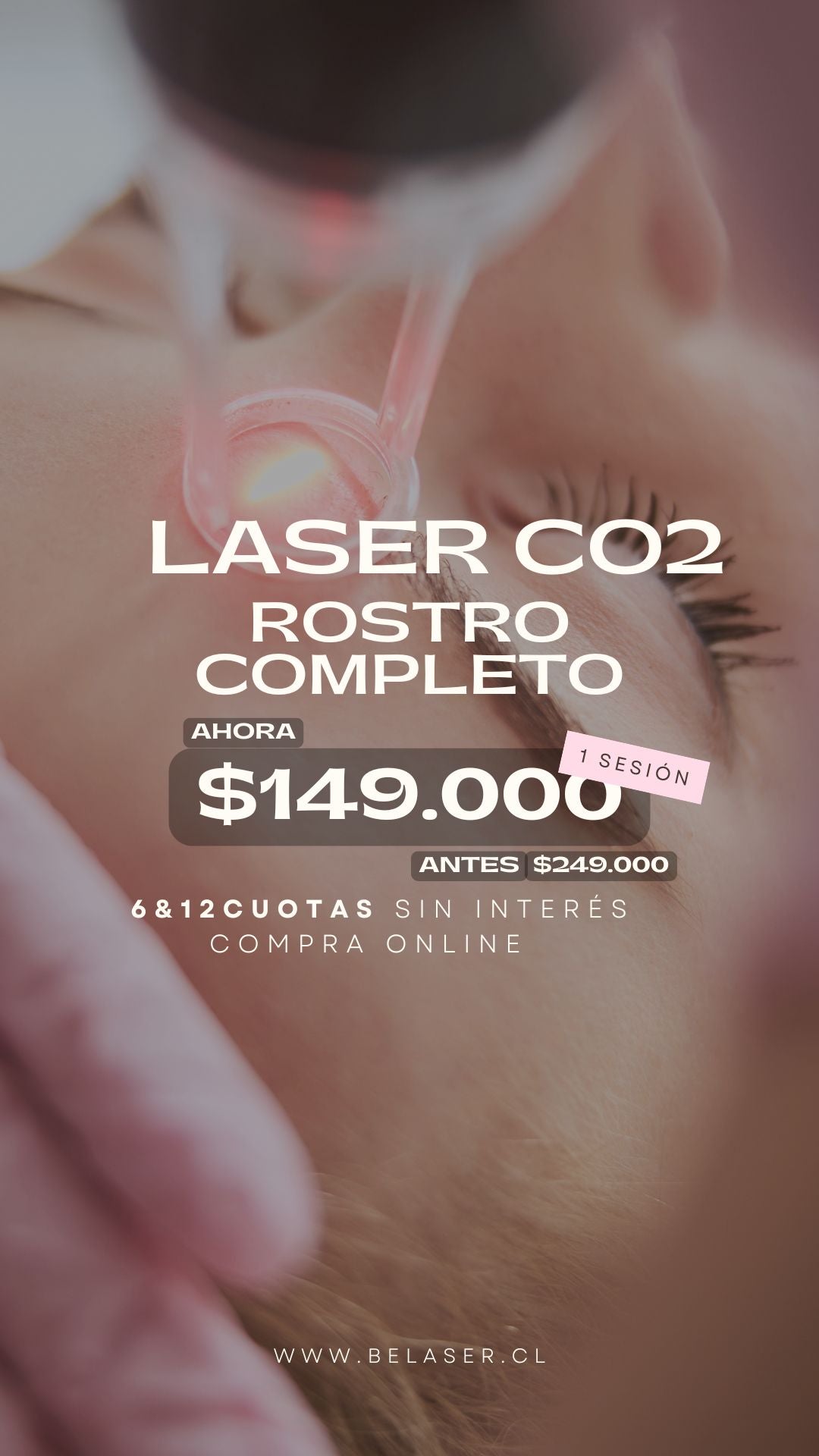 Láser co2