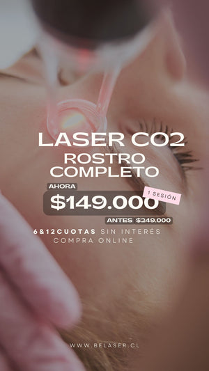 Láser co2