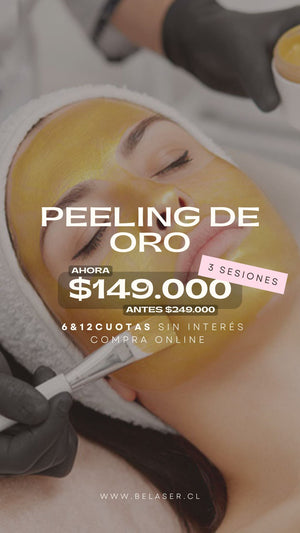 Peeling de oro