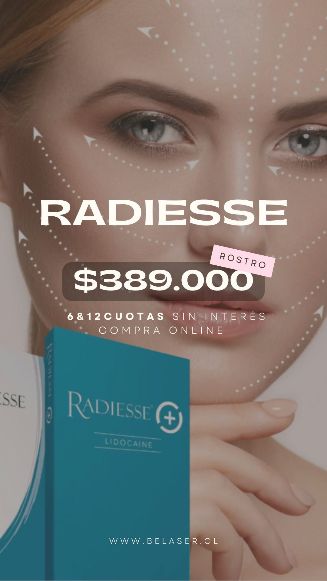 Radiesse