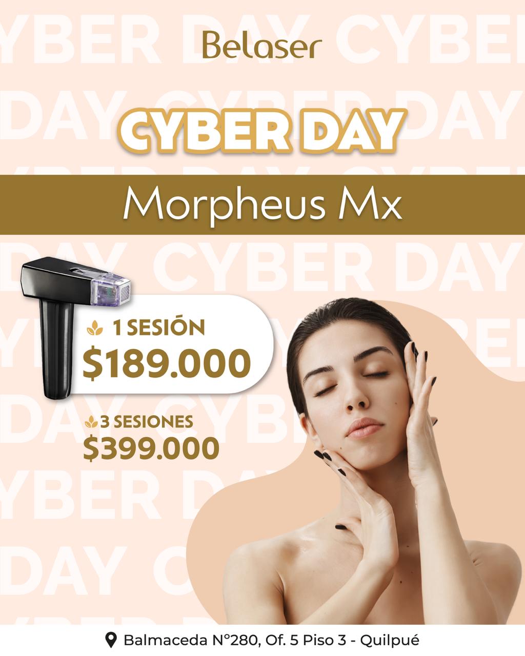 Morpheus MX
