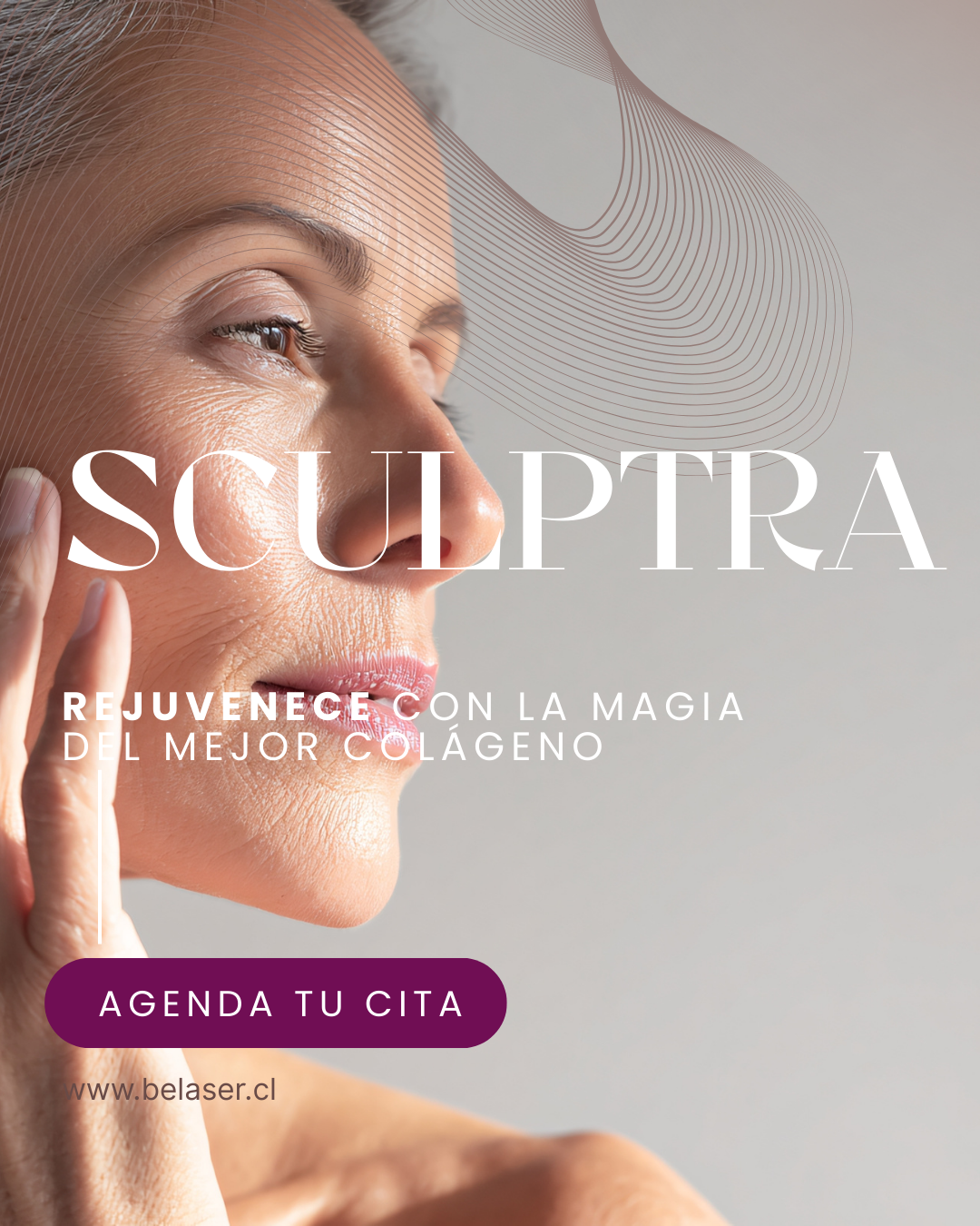 Sculptra