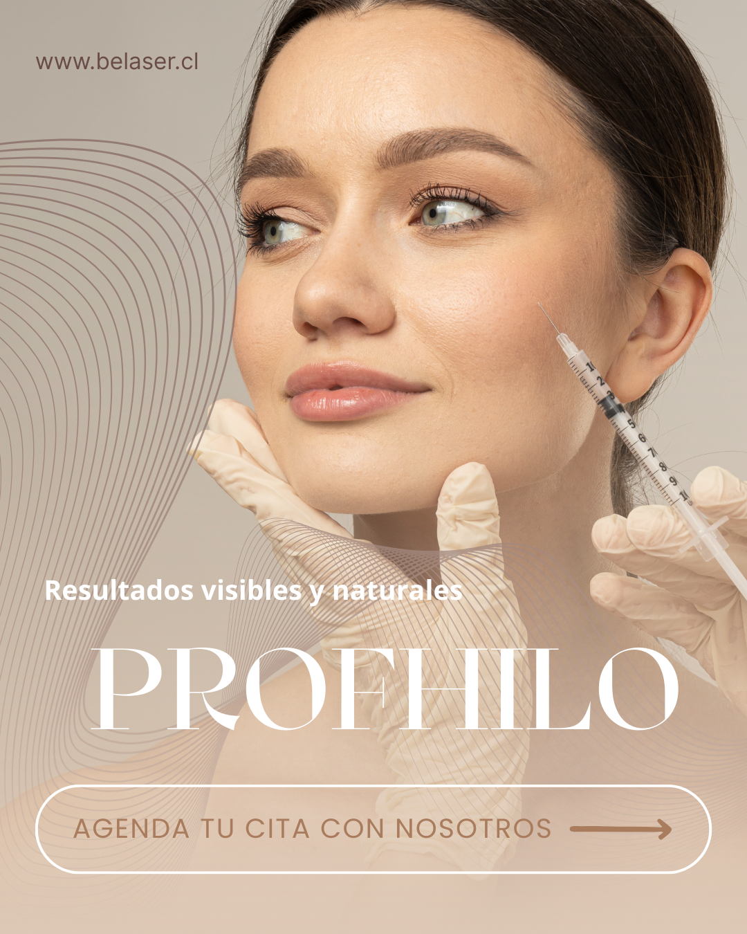 Profhilo