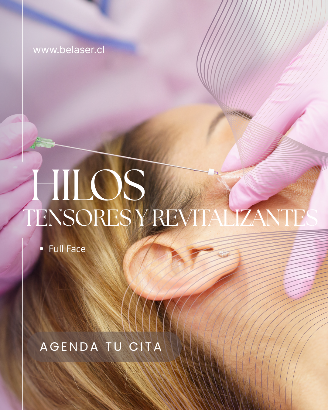 Hilos Tensores