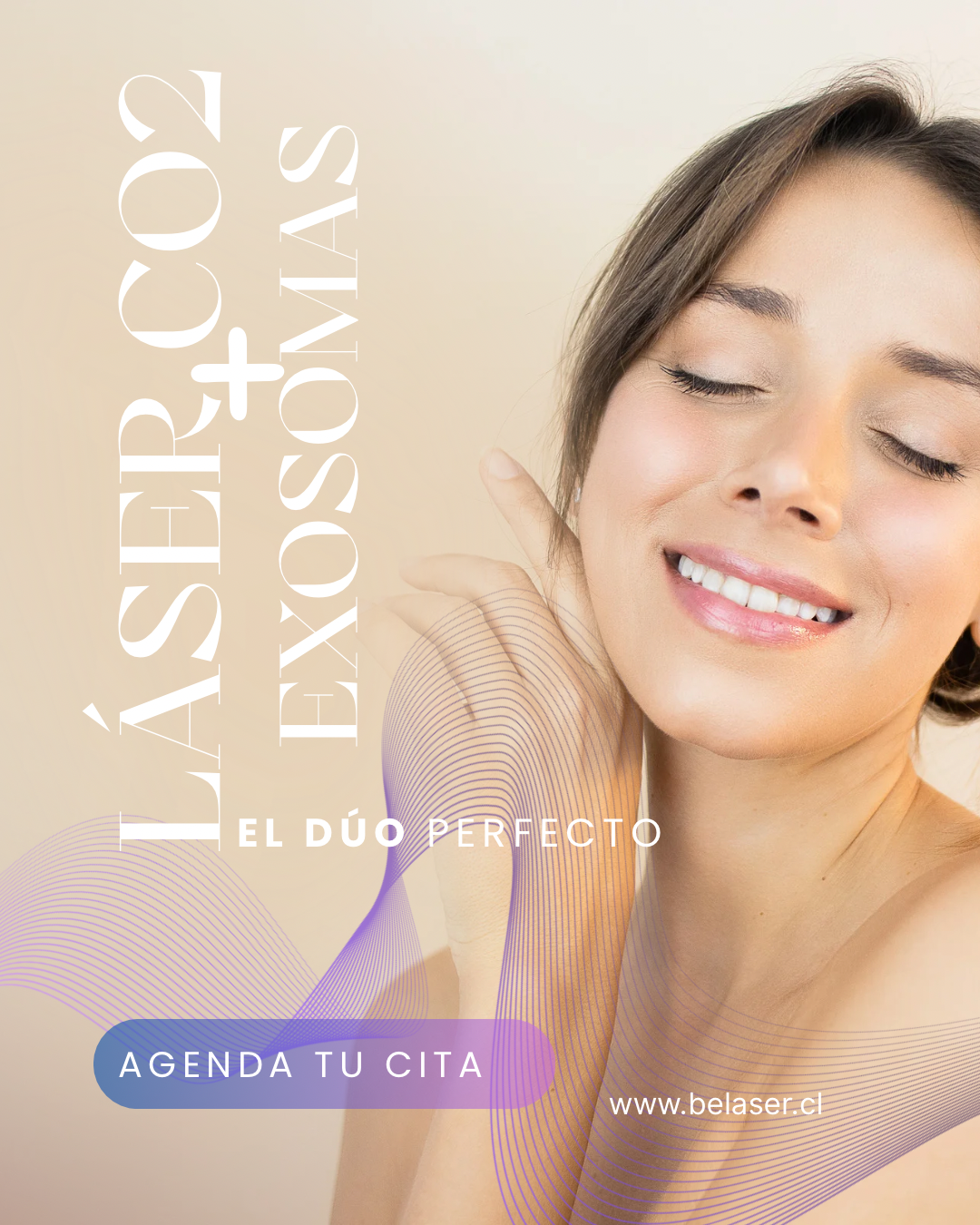 Exosomas + LaserCo2
