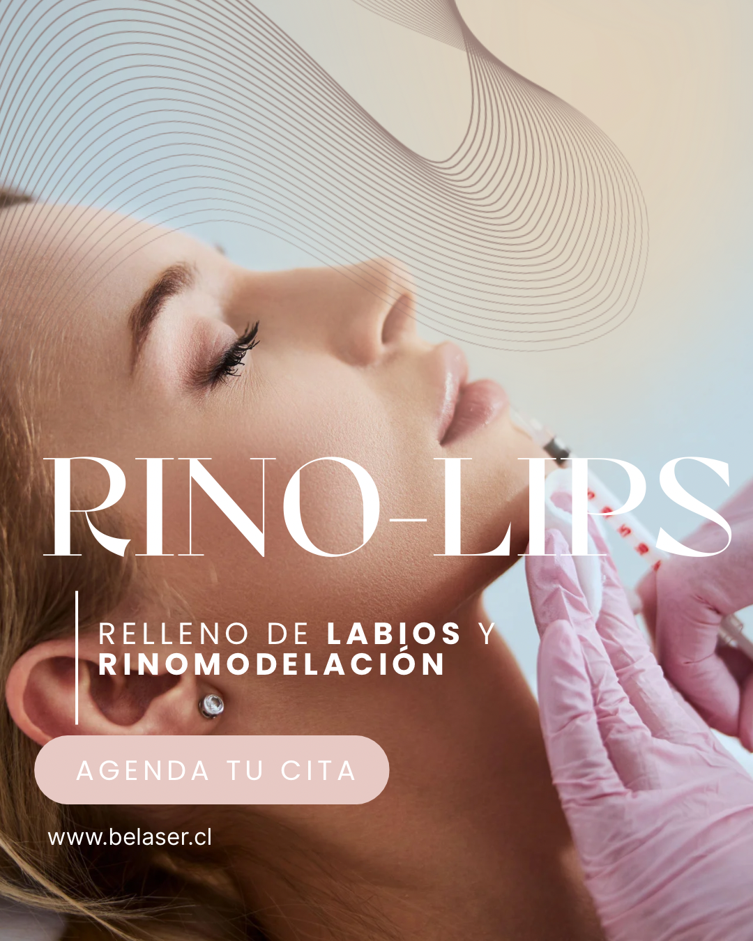 Rino-Lips
