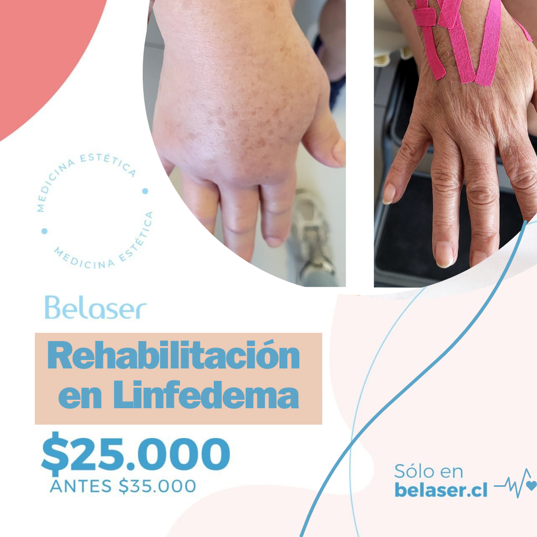 Unidad de linfedema