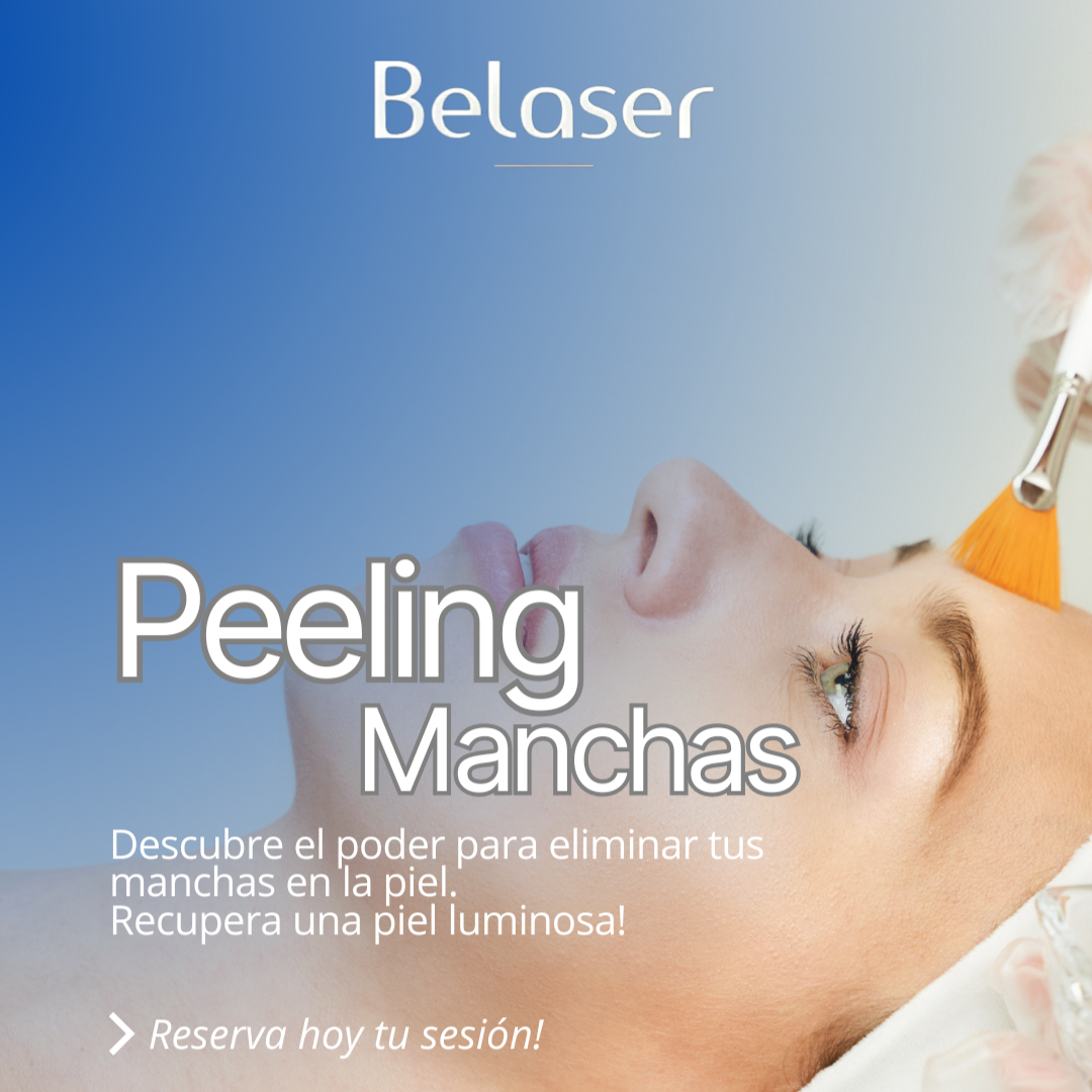 Peeling Facial  Hiperpigmentación Manchas