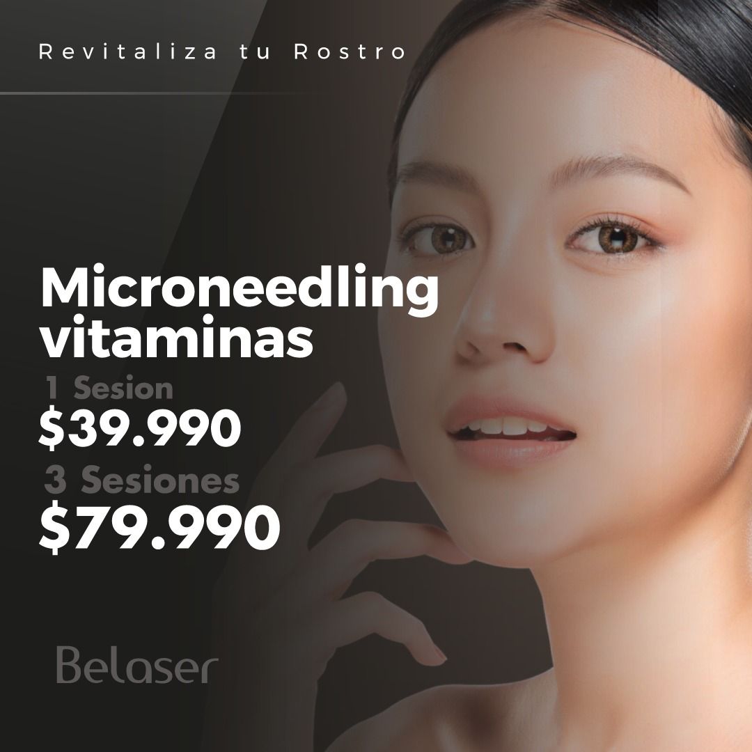 Microneedling Vitaminas Biorevitalizante