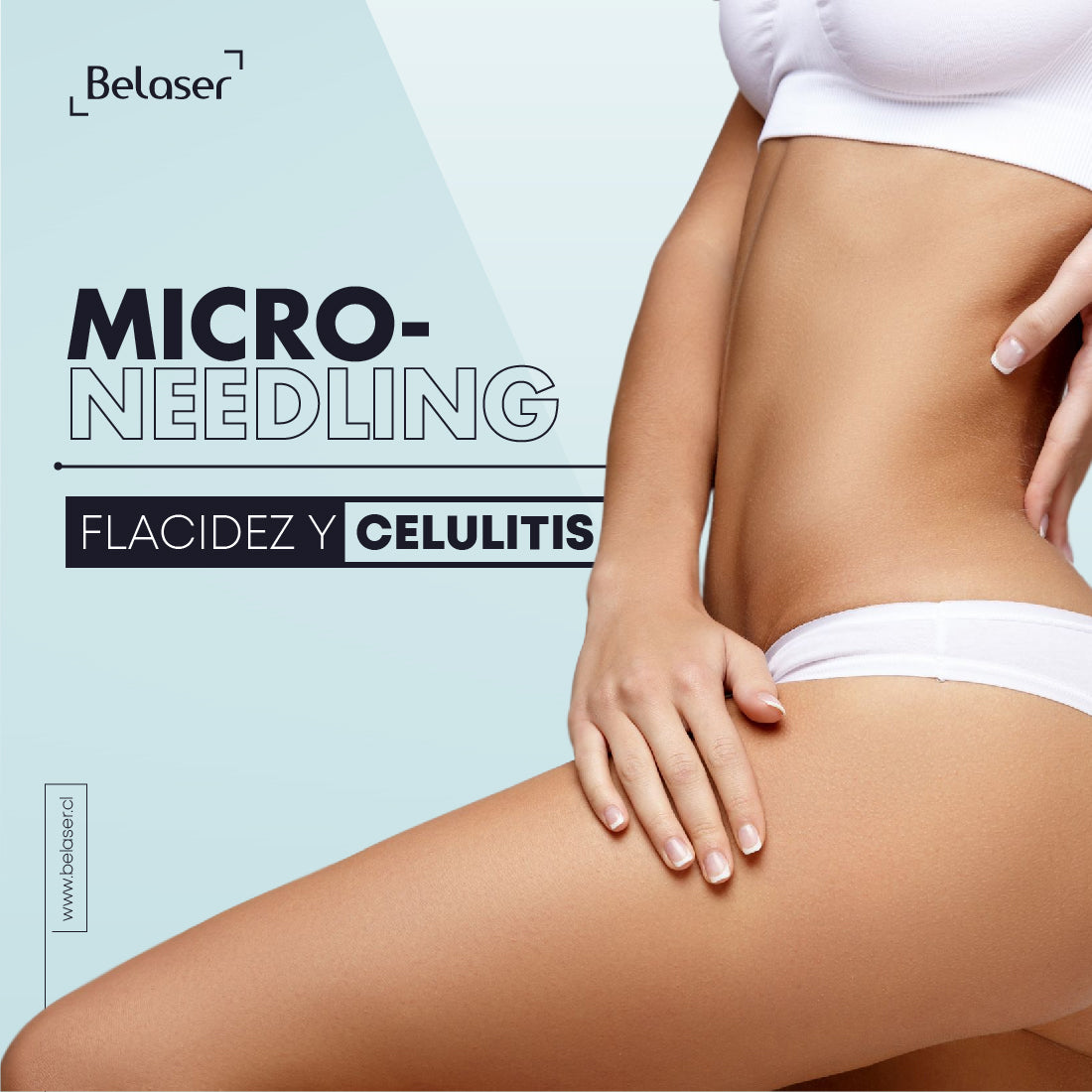 Microneedling  Flacidez y Celulitis